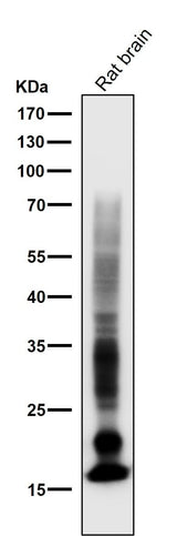 Anti-Myelin Basic Protein MBP Rabbit Monoclonal Antibody Boster Bio