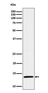 Anti-IL15 Rabbit Monoclonal Antibody Boster Bio