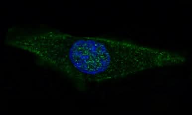 Anti-GFAP Rabbit Monoclonal Antibody Boster Bio