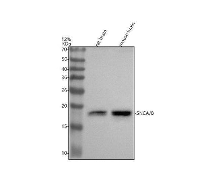 Anti-alpha + beta Synuclein SNCA Rabbit Monoclonal Antibody Boster Bio