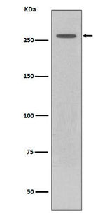 Anti-LRRK2 Rabbit Monoclonal Antibody Boster Bio