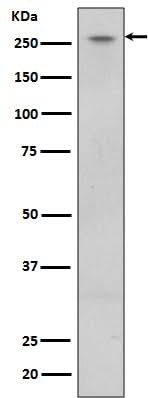 Anti-LRRK2 Rabbit Monoclonal Antibody Boster Bio
