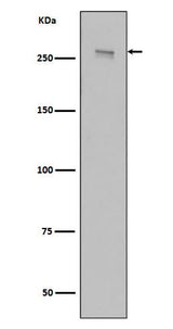 Anti-LRRK2 Rabbit Monoclonal Antibody Boster Bio