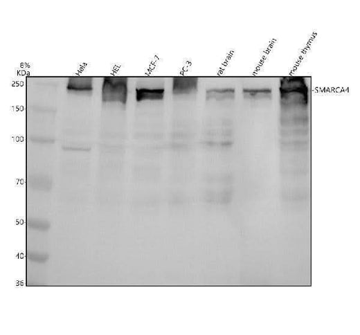 Anti-BRG1 Rabbit Monoclonal Antibody Boster Bio