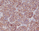 Anti-TNFAIP3/A20 Rabbit Monoclonal Antibody Boster Bio
