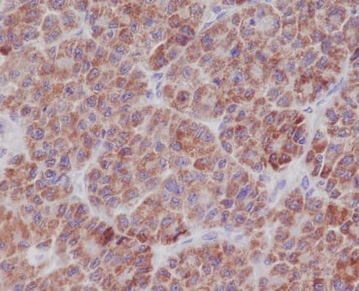 Anti-TNFAIP3/A20 Rabbit Monoclonal Antibody Boster Bio