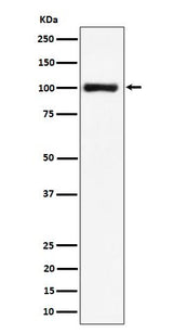 Anti-Nucleolin Rabbit Monoclonal Antibody Boster Bio
