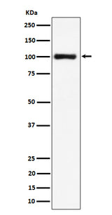 Anti-Nucleolin Rabbit Monoclonal Antibody Boster Bio