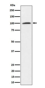Anti-Nucleolin Rabbit Monoclonal Antibody Boster Bio