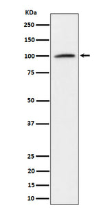 Anti-Nucleolin Rabbit Monoclonal Antibody Boster Bio