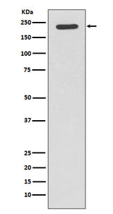 Anti-Tuberin TSC2 Rabbit Monoclonal Antibody Boster Bio