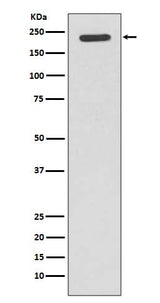 Anti-Tuberin TSC2 Rabbit Monoclonal Antibody Boster Bio