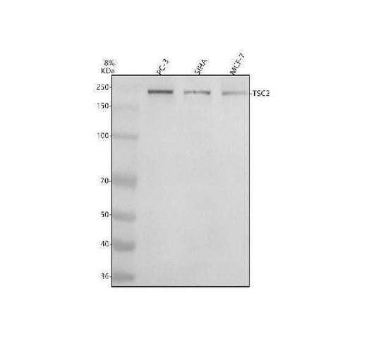 Anti-Phospho-Tuberin (S939) Rabbit Monoclonal Antibody Boster Bio