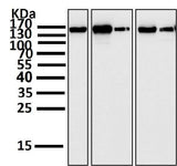 Anti-FGFR2 Rabbit Monoclonal Antibody Boster Bio