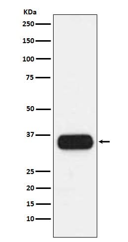 Anti-HLA-DQA1 Monoclonal Antibody Boster Bio