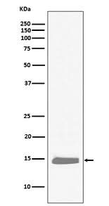 Anti-Hemoglobin subunit alpha HBA1 Rabbit Monoclonal Antibody Boster Bio