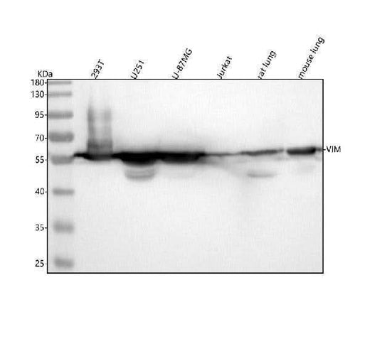 Anti-Vimentin Rabbit Monoclonal Antibody Boster Bio