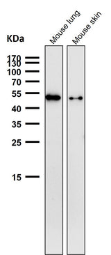 Anti-Phospho-Vimentin (S39) Rabbit Monoclonal Antibody Boster Bio