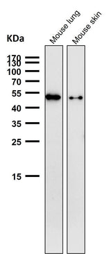 Anti-Phospho-Vimentin (S39) Rabbit Monoclonal Antibody Boster Bio