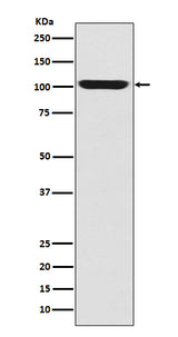 Anti-LGR5/GPR49 Rabbit Monoclonal Antibody Boster Bio