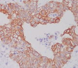 Anti-ATG5/Apg5 Rabbit Monoclonal Antibody Boster Bio