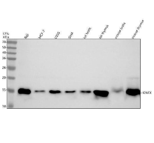 Anti-Histone H2A.X H2AFX Rabbit Monoclonal Antibody Boster Bio