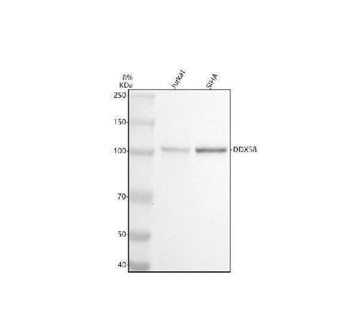 Anti-DDX58 Monoclonal Antibody Boster Bio