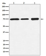 Anti-BTK Rabbit Monoclonal Antibody Boster Bio