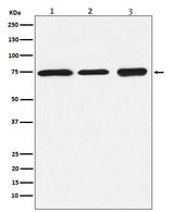 Anti-BTK Rabbit Monoclonal Antibody Boster Bio