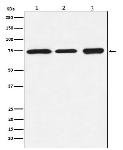 Anti-BTK Rabbit Monoclonal Antibody Boster Bio