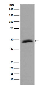 Anti-Aurora A AURKA Rabbit Monoclonal Antibody Boster Bio
