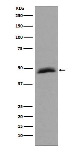Anti-Aurora A AURKA Rabbit Monoclonal Antibody Boster Bio