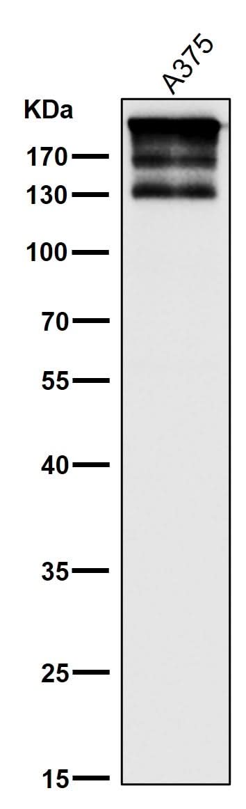 Anti-ARID1A Rabbit Monoclonal Antibody Boster Bio