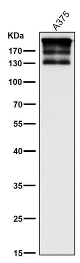 Anti-ARID1A Rabbit Monoclonal Antibody Boster Bio