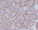 Anti-CD147 BSG Rabbit Monoclonal Antibody Boster Bio