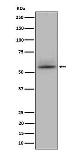 Anti-CD147 Rabbit Monoclonal Antibody Boster Bio