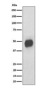 Anti-CD147 Rabbit Monoclonal Antibody Boster Bio