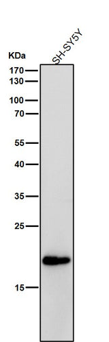 Anti-C Reactive Protein Rabbit Monoclonal Antibody Boster Bio