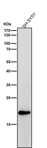 Anti-C Reactive Protein Rabbit Monoclonal Antibody Boster Bio