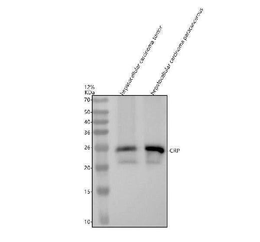 Anti-C Reactive Protein CRP Rabbit Monoclonal Antibody Boster Bio