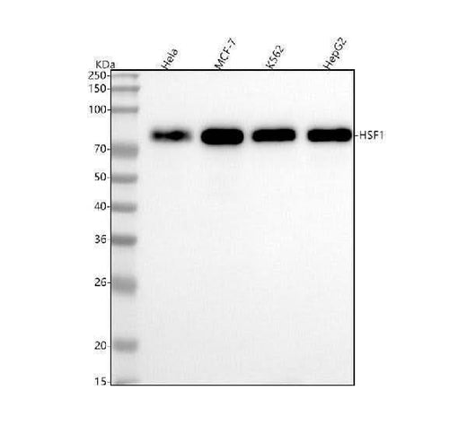 Anti-HSF1 Rabbit Monoclonal Antibody Boster Bio