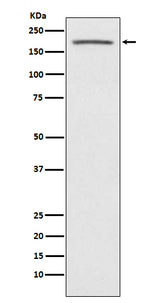Anti-ACE1 Monoclonal Antibody Boster Bio