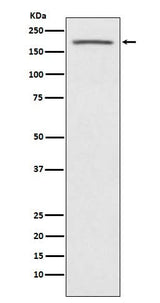 Anti-ACE1 Monoclonal Antibody Boster Bio