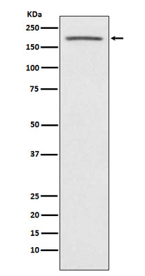 Anti-ACE1 Monoclonal Antibody Boster Bio