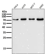Anti-FoxO3a Rabbit Monoclonal Antibody Boster Bio
