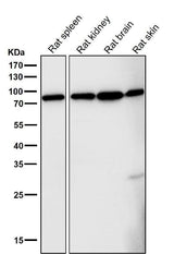 Anti-FoxO3a Rabbit Monoclonal Antibody Boster Bio