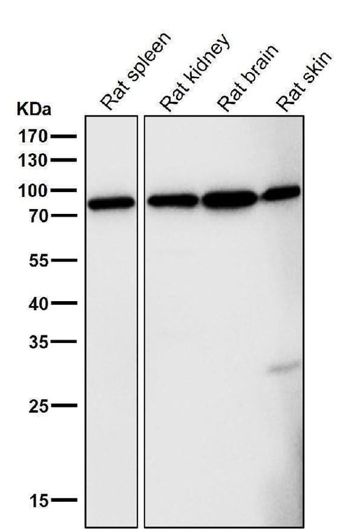 Anti-FoxO3a Rabbit Monoclonal Antibody Boster Bio