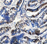 Anti-Ki67/MKI67 Rabbit Monoclonal Antibody Boster Bio