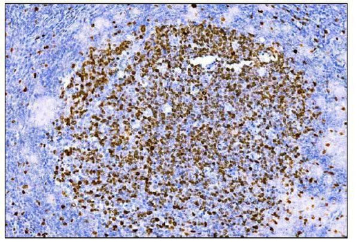 Anti-Ki67 Antibody (monoclonal, 5E12 Boster Bio