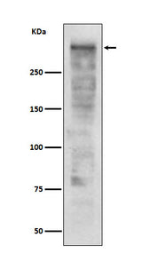 Anti-Ki67 MKI67 Rabbit Monoclonal Antibody Boster Bio